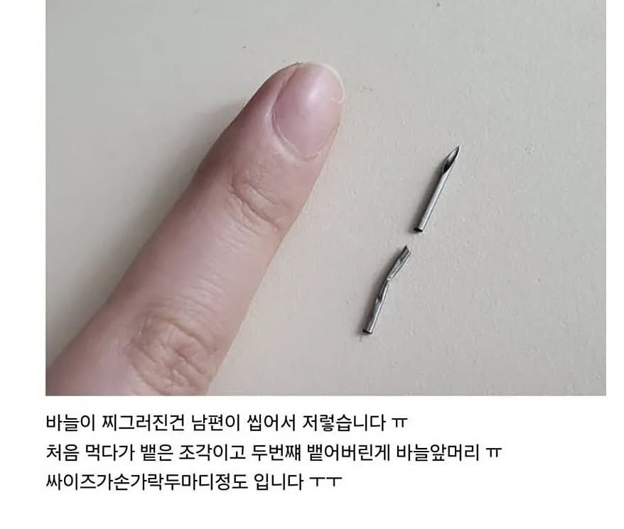 소고기먹다가-주사바늘-나옴-5-이미지