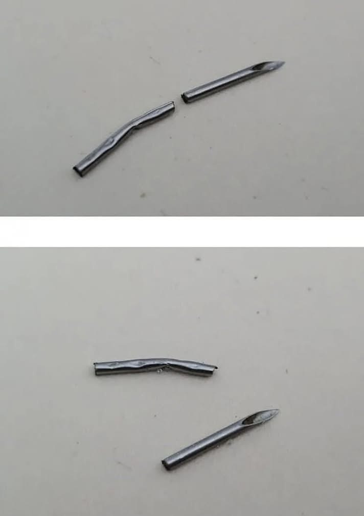 소고기먹다가-주사바늘-나옴-4-이미지