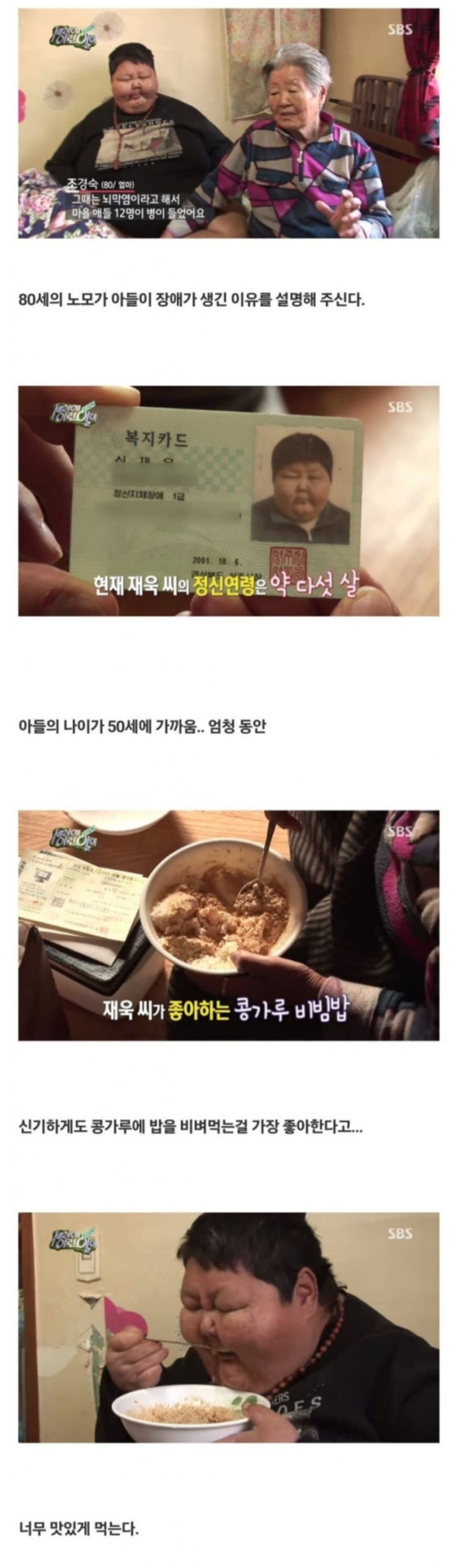 초고도비만-아들과-팔순-노모의-동행-0-이미지