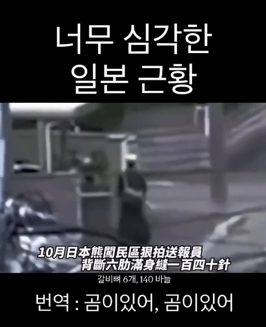 (짤주의)-진짜-심각하다는-일본의-곰-습격-피해.gif-0-이미지