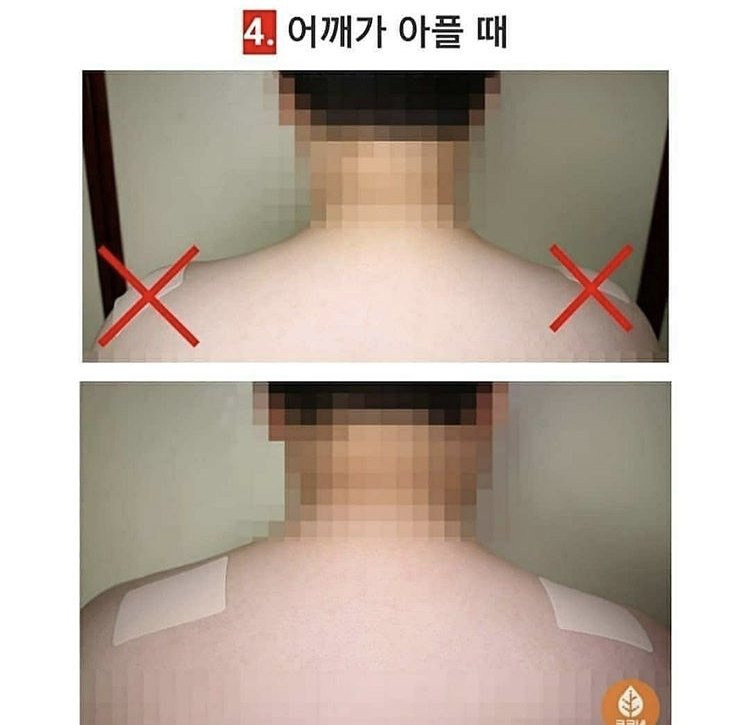 파스-이렇게-붙이세요-체질이란게-바뀝니다-3-이미지