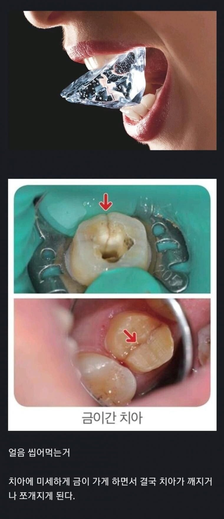 치아의-수명을-줄이는-최악의-행위-0-이미지