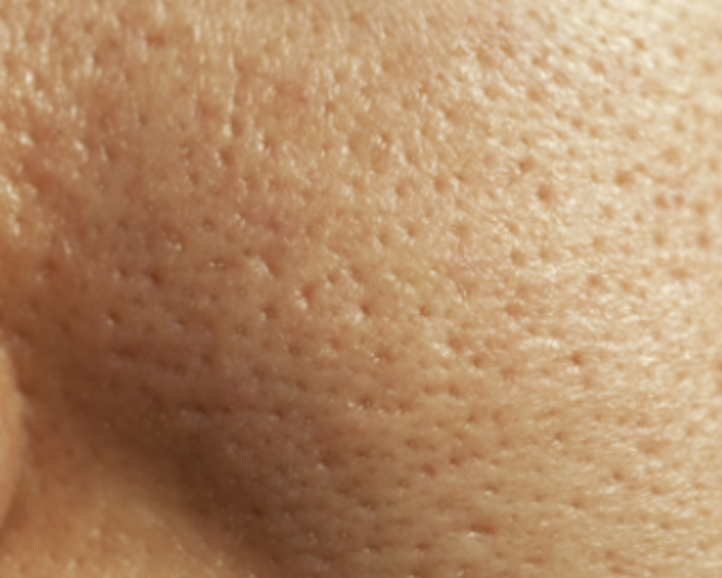 7년차-피부과-직원이-말해준-피부고민별-관리비법(모공,여드름,노화,수분,블랙헤드)-3-이미지