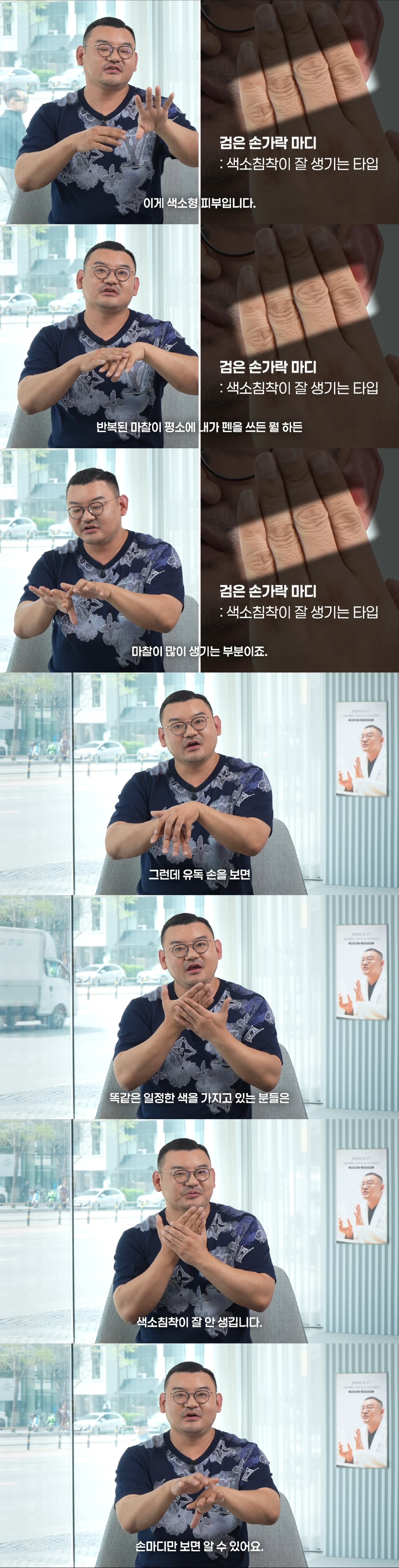 내가-색소침착이-잘-생기는-피부인지-아닌지-한-번에-알아보는-법-1-이미지