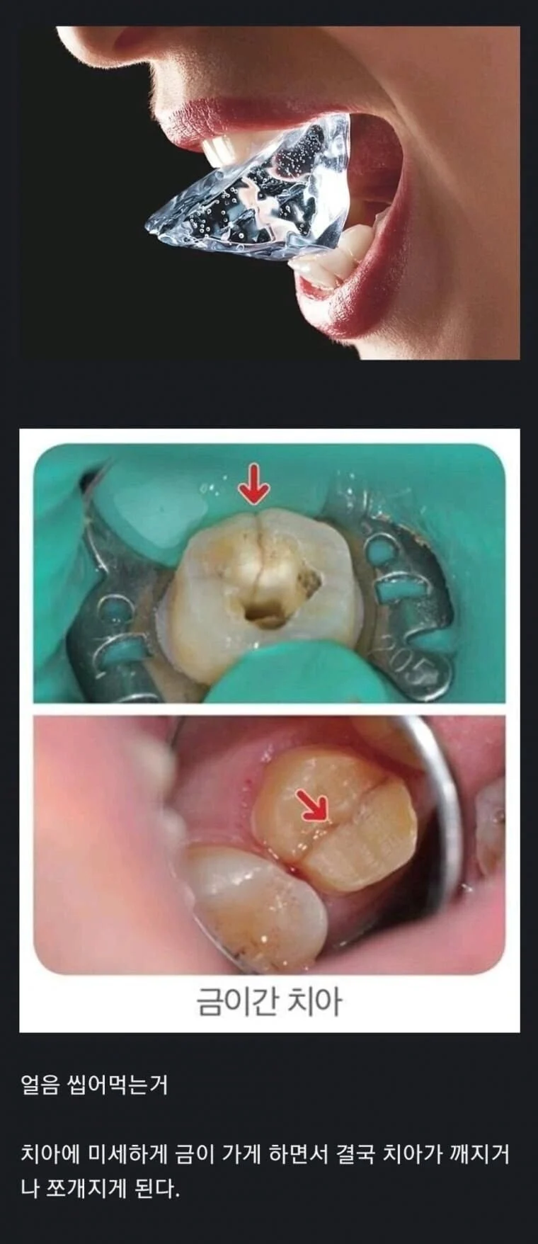 치과에서-하지말라는-거-0-이미지