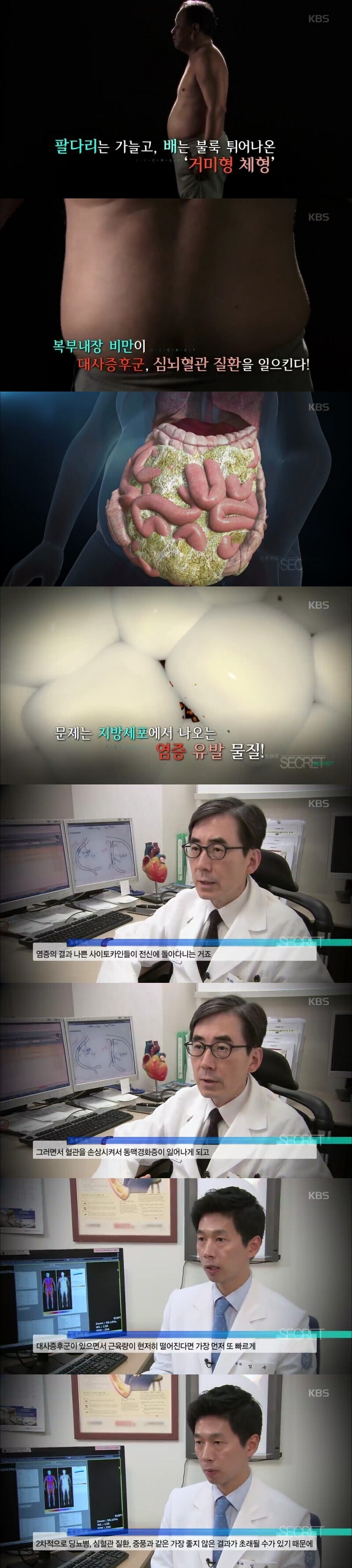 부모님이-이-체형이면-반드시-운동하셔야-함.jpg-1-이미지