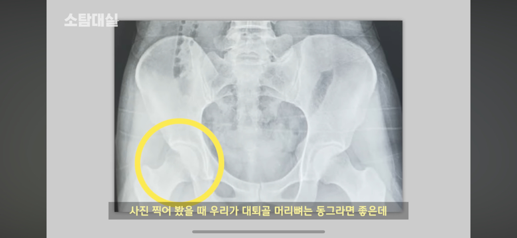 태생부터-다리찢기를-하면-안되는-고관절이-있음-18-이미지