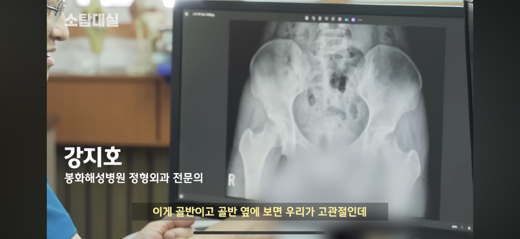 태생부터-다리찢기를-하면-안되는-고관절이-있음-0-이미지