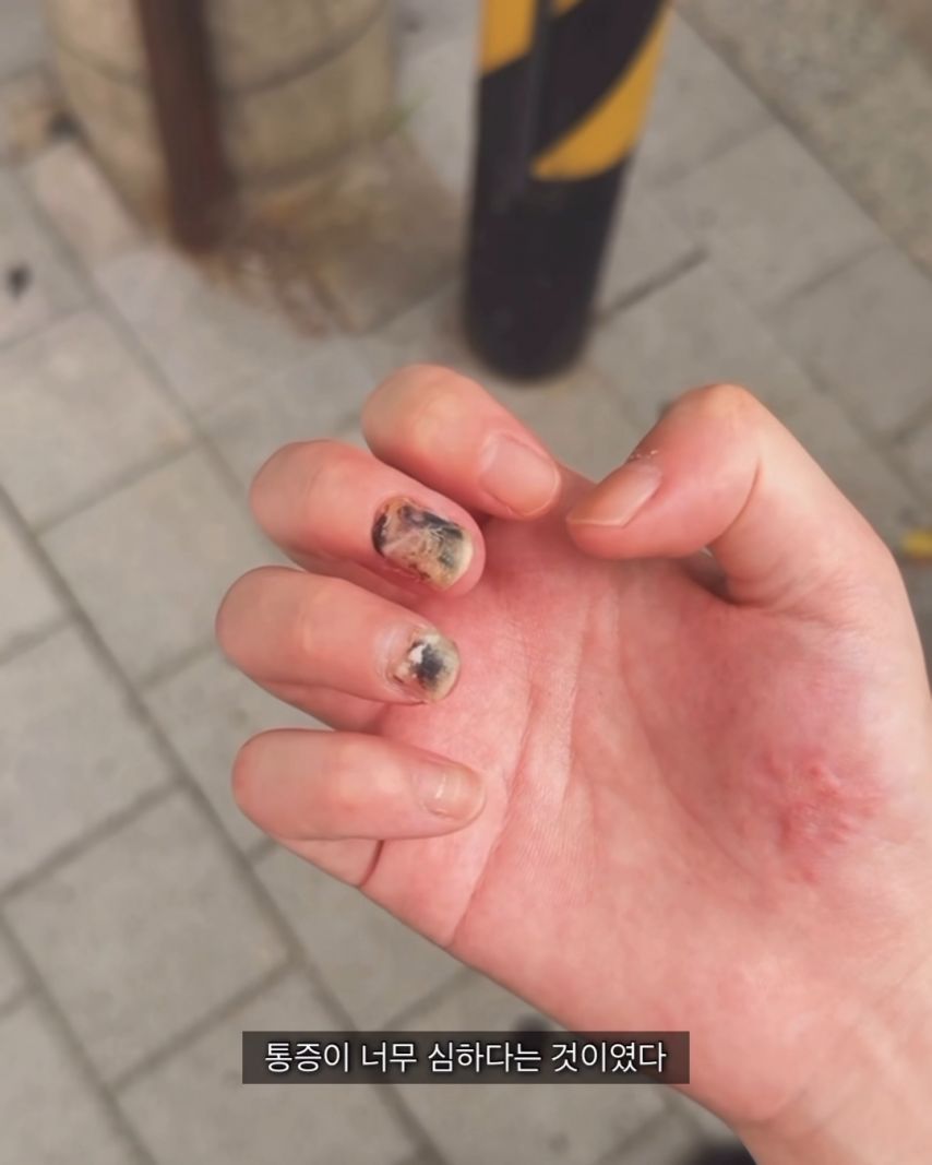 오토바이-사고가-무서운-이유.jpg-13-이미지