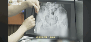 태생부터-다리찢기를-하면-안되는-고관절이-있음-4-이미지