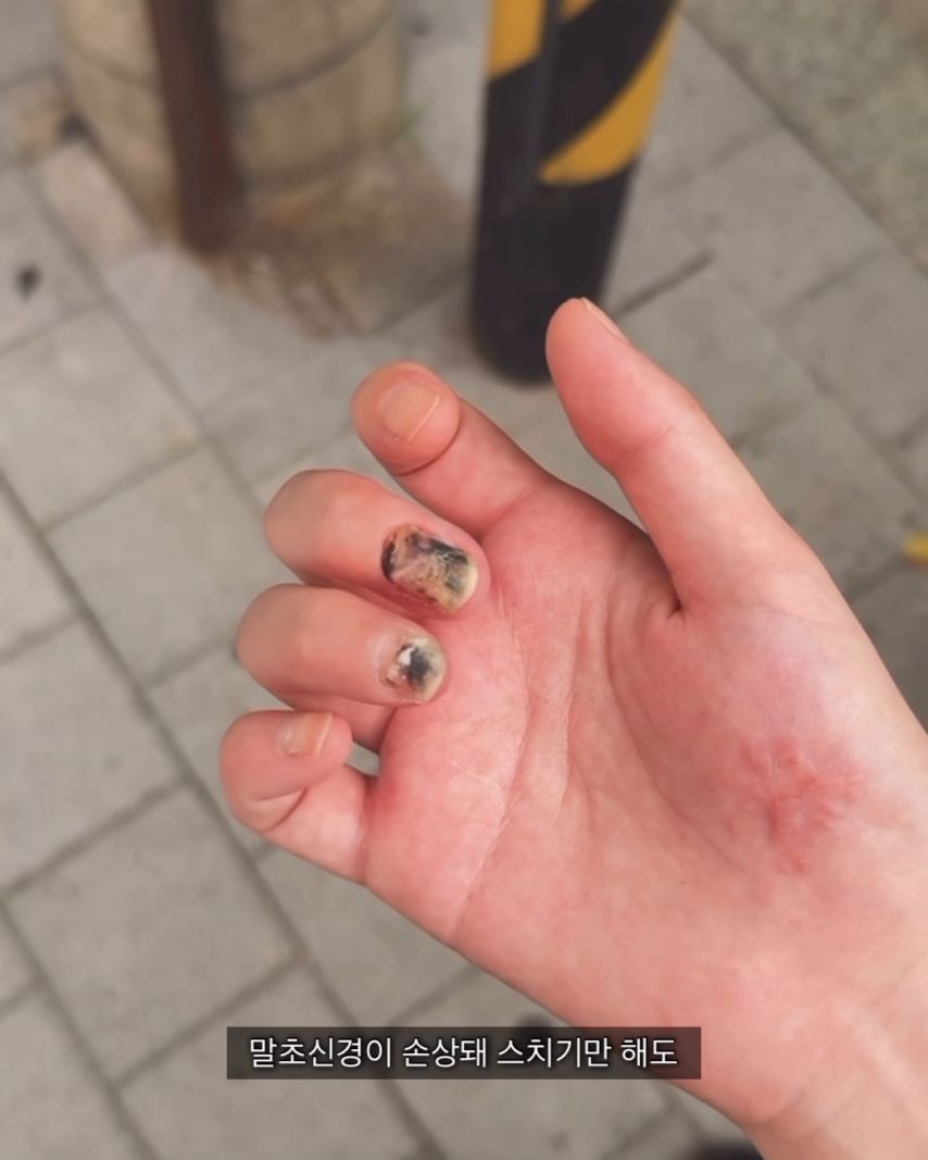 오토바이-사고가-무서운-이유.jpg-12-이미지