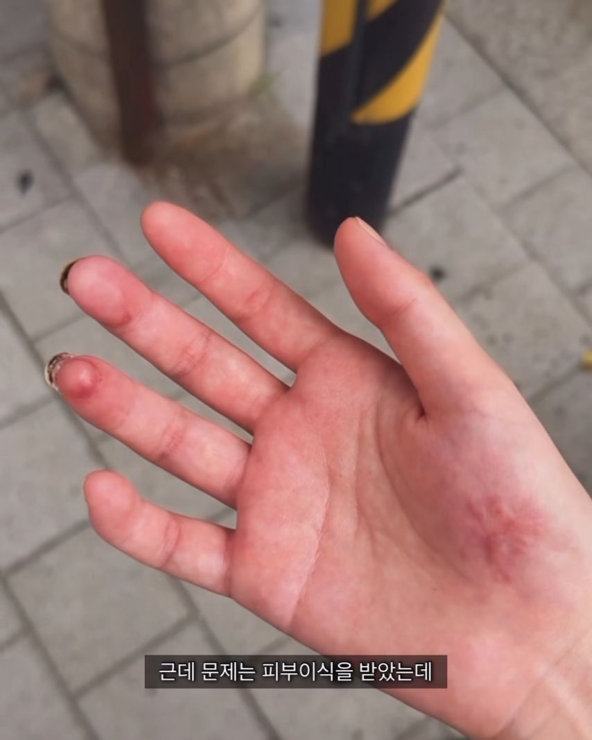 오토바이-사고가-무서운-이유.jpg-11-이미지