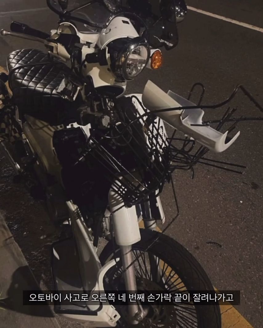 오토바이-사고가-무서운-이유.jpg-3-이미지