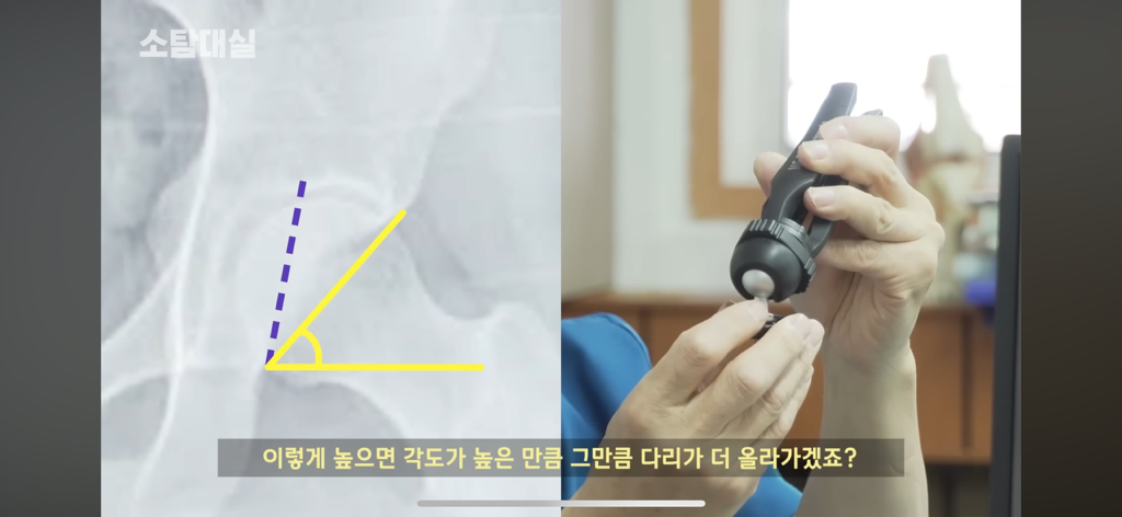 태생부터-다리찢기를-하면-안되는-고관절이-있음-27-이미지