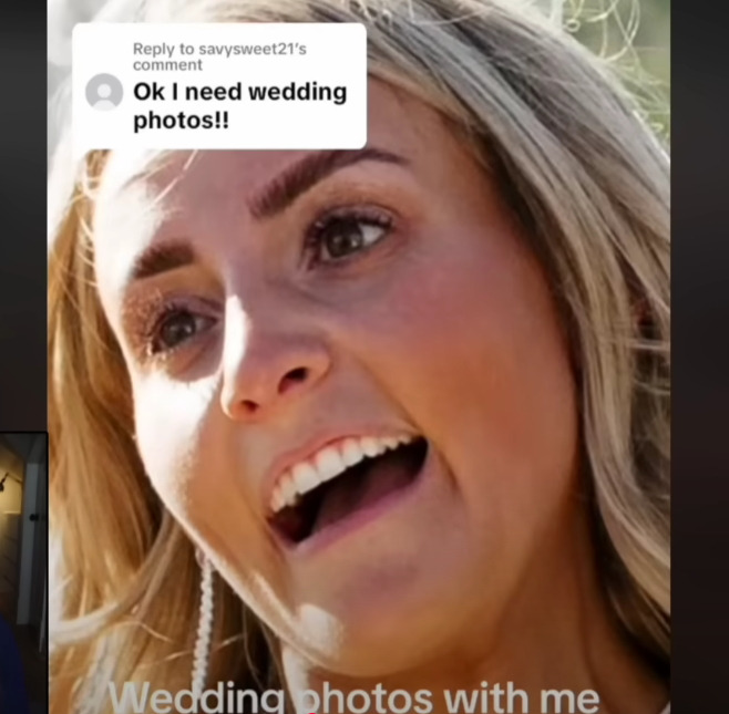 보톡스-주사시술이-불러일으킬-수-있는-부작용-10-이미지