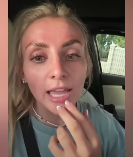 보톡스-주사시술이-불러일으킬-수-있는-부작용-7-이미지