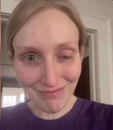 보톡스-주사시술이-불러일으킬-수-있는-부작용-4-이미지