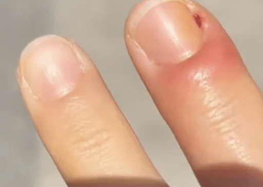 더-아프고-거슬리는-것-고르기-1-이미지