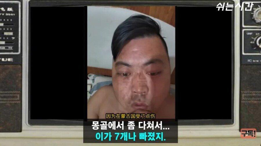 몽골에서-헛소리-하다-옥수수-털린-중국인-2-이미지