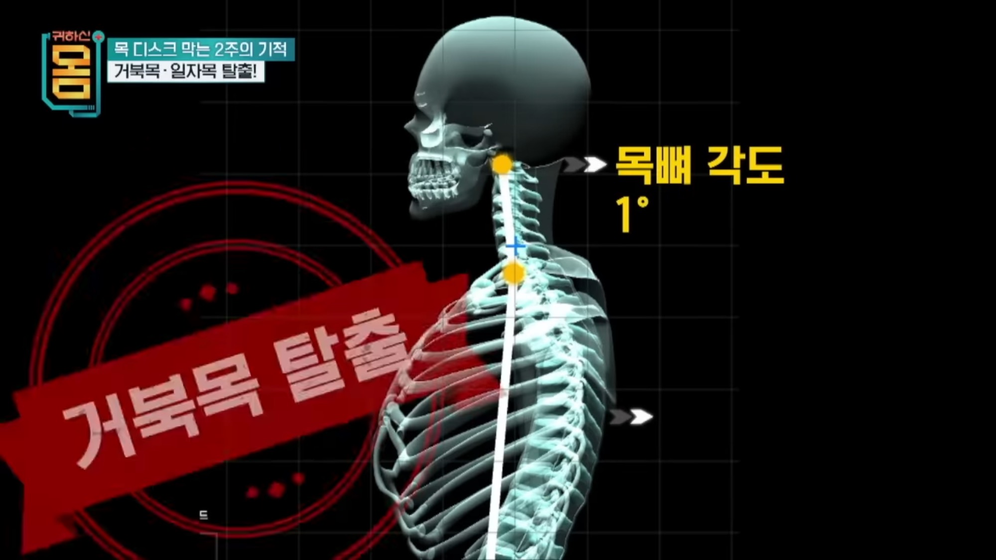 2주만에-효과-대박인-거북목•일자목-마사지&운동-28-이미지