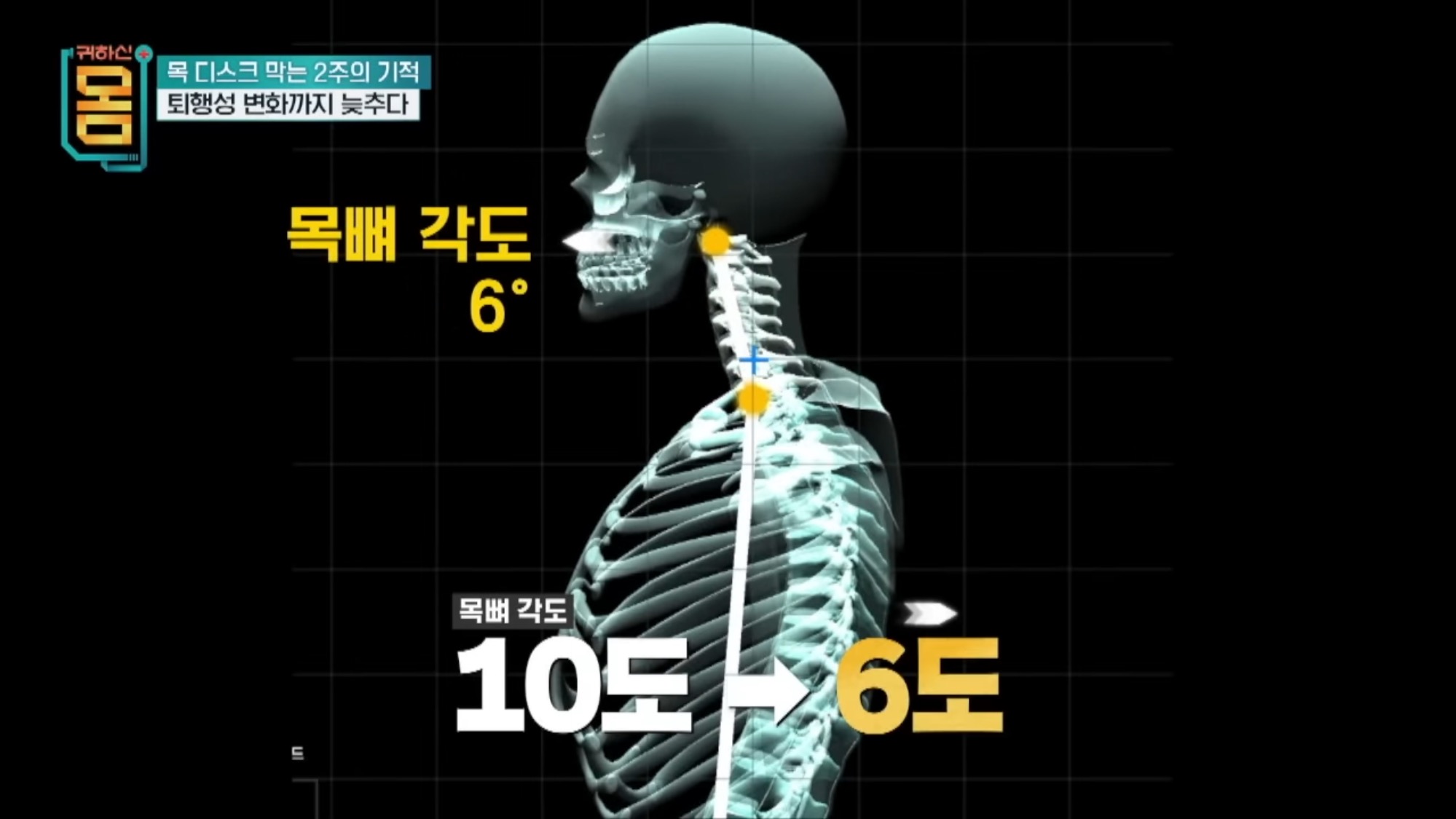 2주만에-효과-대박인-거북목•일자목-마사지&운동-32-이미지