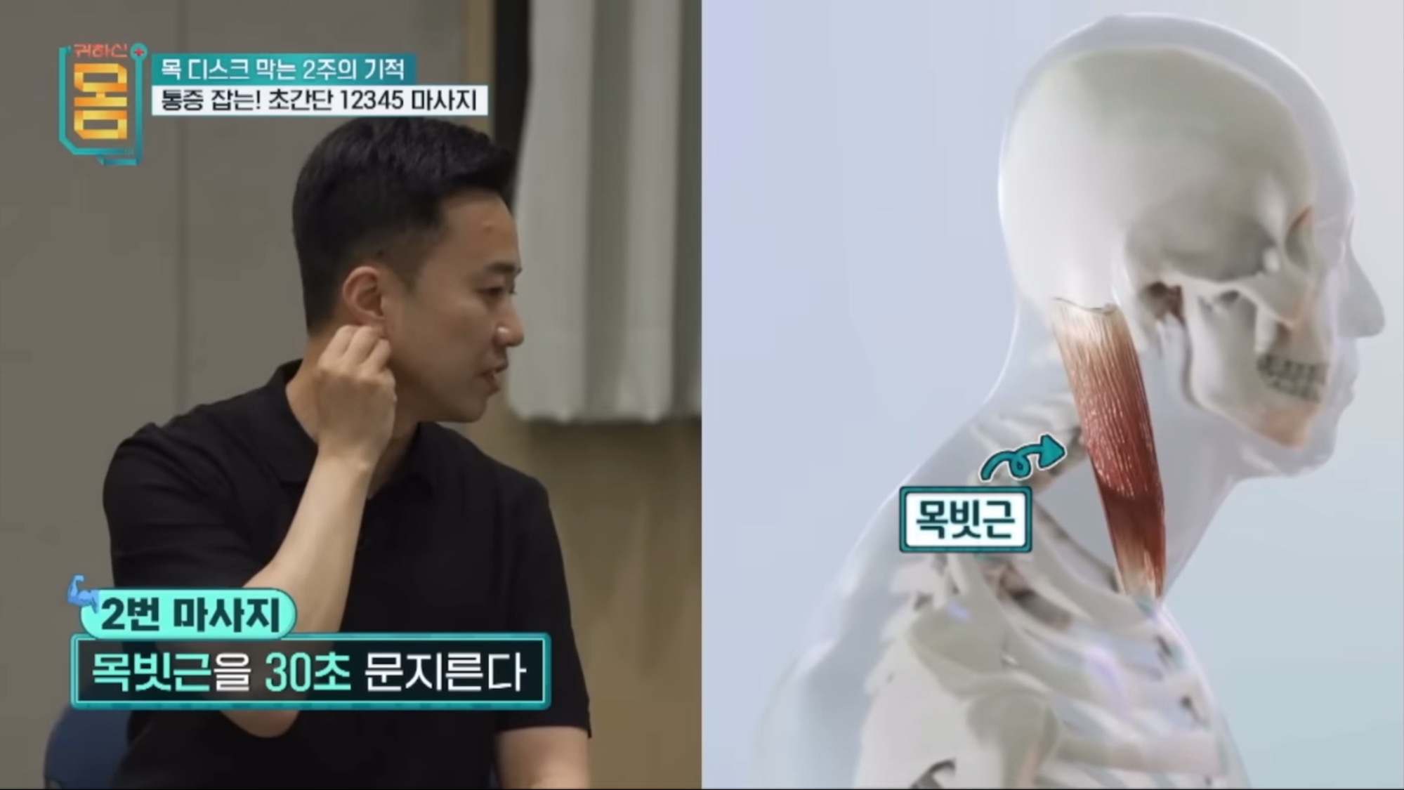 2주만에-효과-대박인-거북목•일자목-마사지&운동-3-이미지