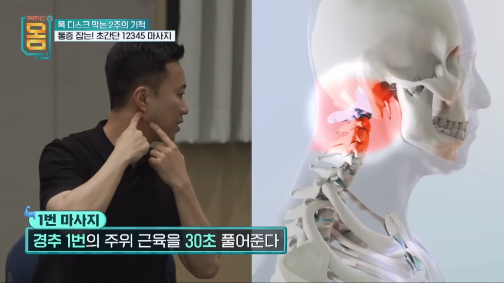 2주만에-효과-대박인-거북목•일자목-마사지&운동-1-이미지