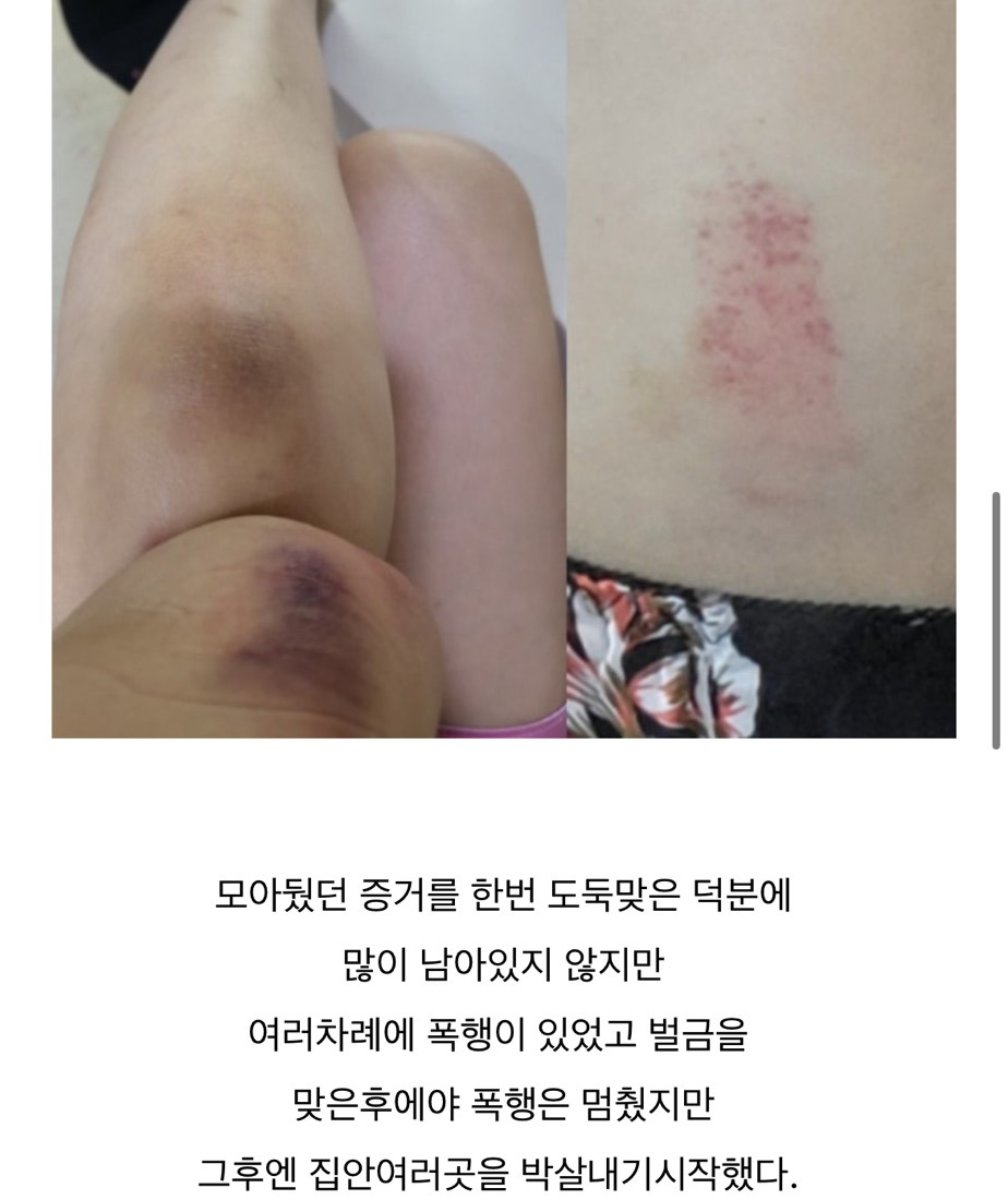 너무-충격적인-이혼숙려캠프-투병부부-아내분-블로그-글-업데이트-4-이미지