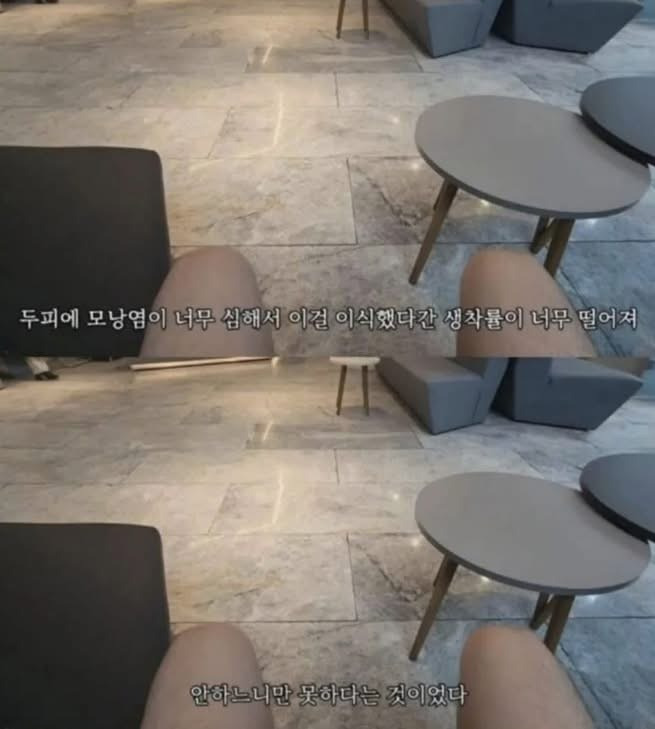 터키로-모발-이식-하러-간-사람에게-일어난-일-3-이미지