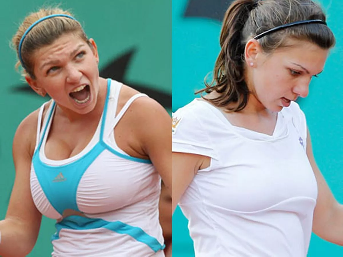 살기-위해-가슴-축소-수술을-했다는-유튜버-2-이미지