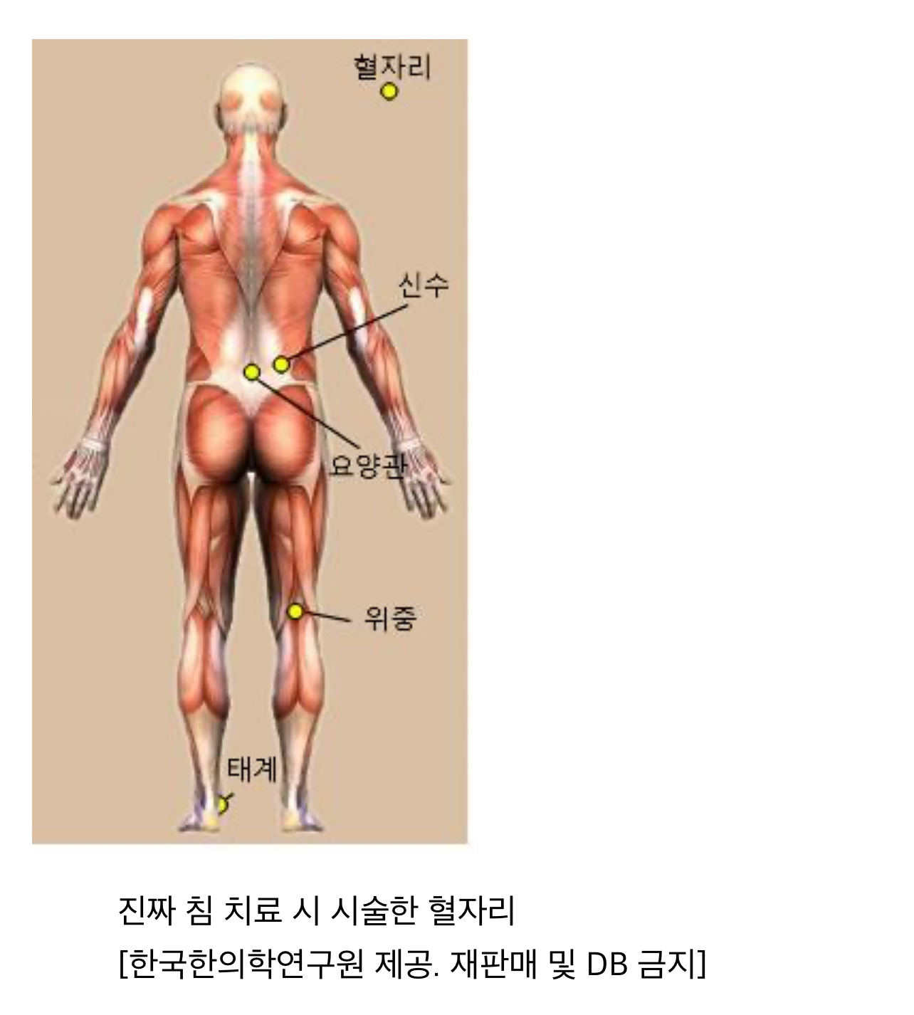 진짜-침이-효과가-있는지-MRI를-써서-알아본-결과-1-이미지