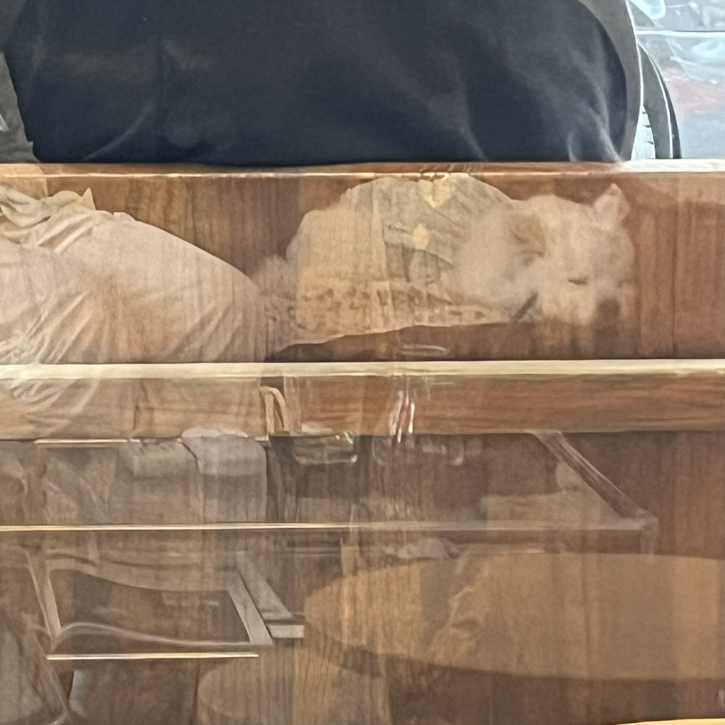 주댕이-털-면도했는데-이거-어캄?!!!-36-이미지