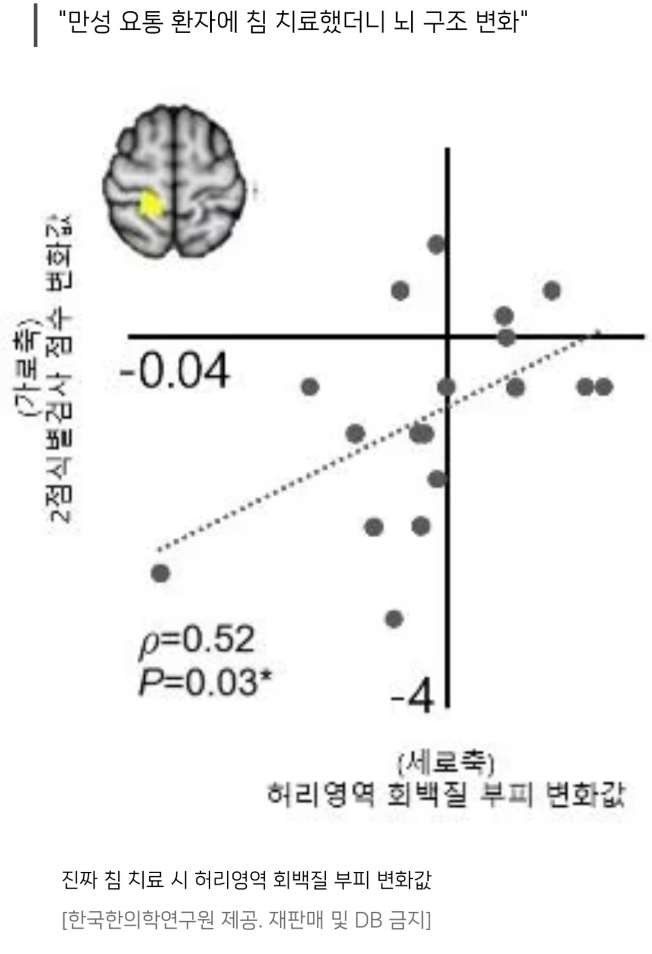 진짜-침이-효과가-있는지-MRI를-써서-알아본-결과-0-이미지
