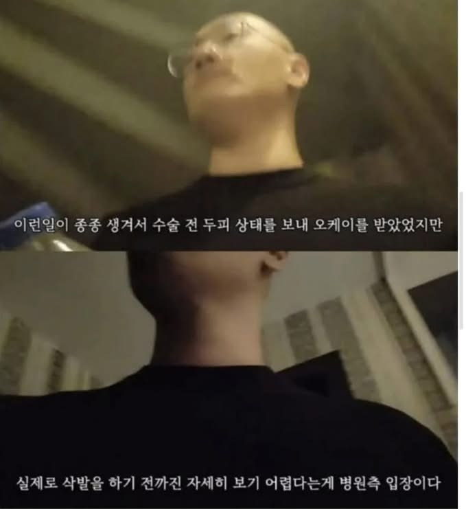 터키로-모발-이식-하러-간-사람에게-일어난-일-4-이미지