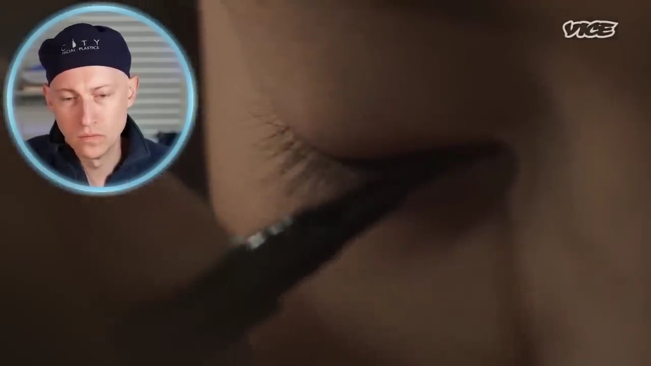 성형수술을-받는-일본-어린아이들.jpg-3-이미지