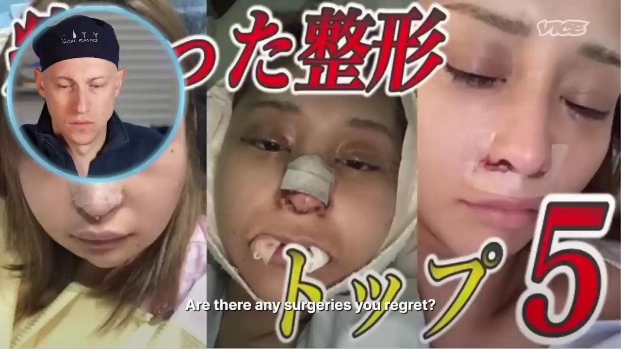 성형수술을-받는-일본-어린아이들.jpg-61-이미지