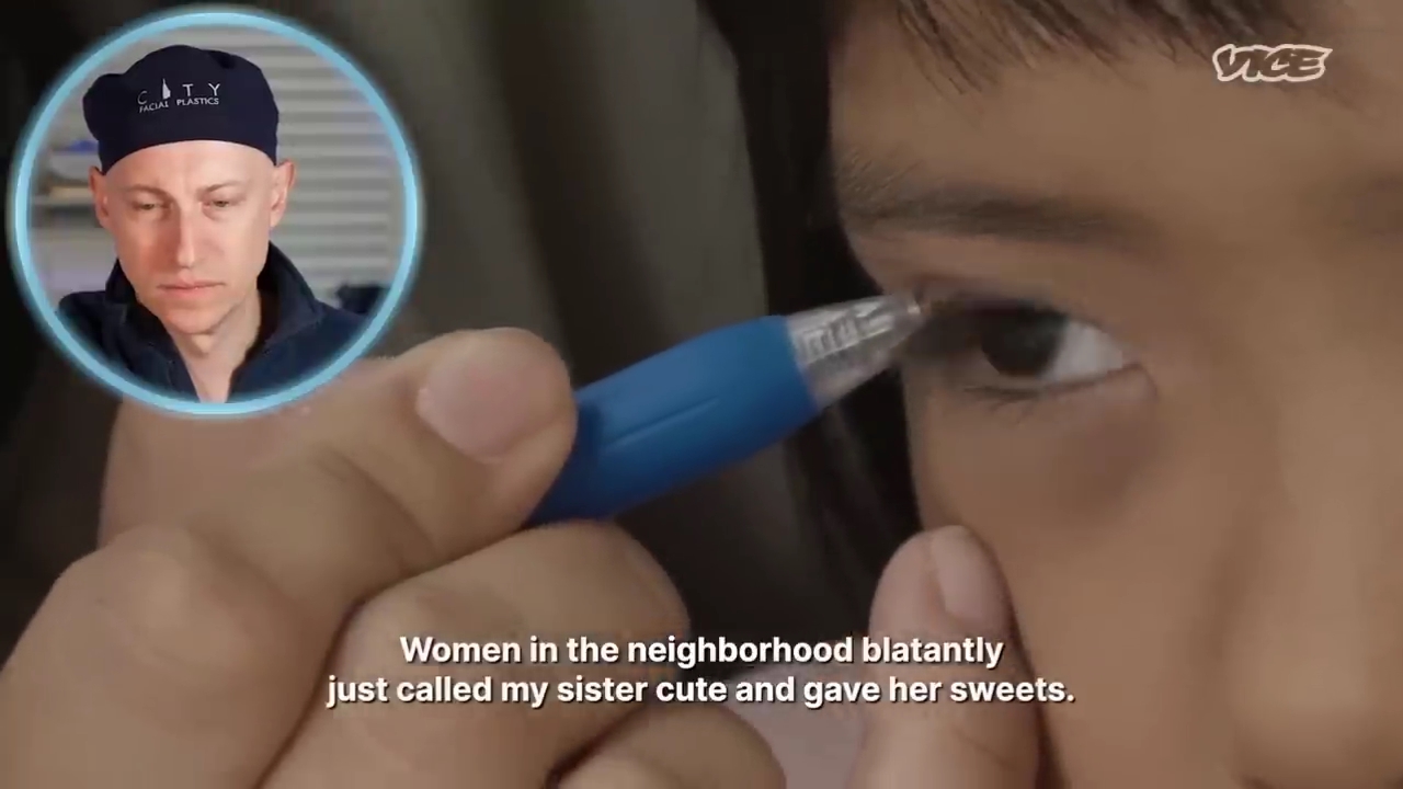 성형수술을-받는-일본-어린아이들.jpg-13-이미지