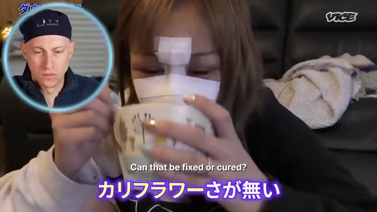 성형수술을-받는-일본-어린아이들.jpg-65-이미지