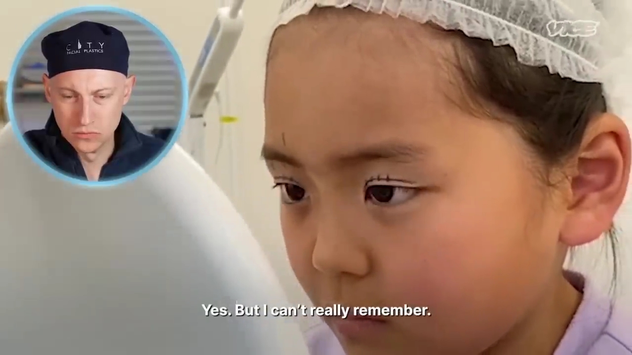 성형수술을-받는-일본-어린아이들.jpg-18-이미지