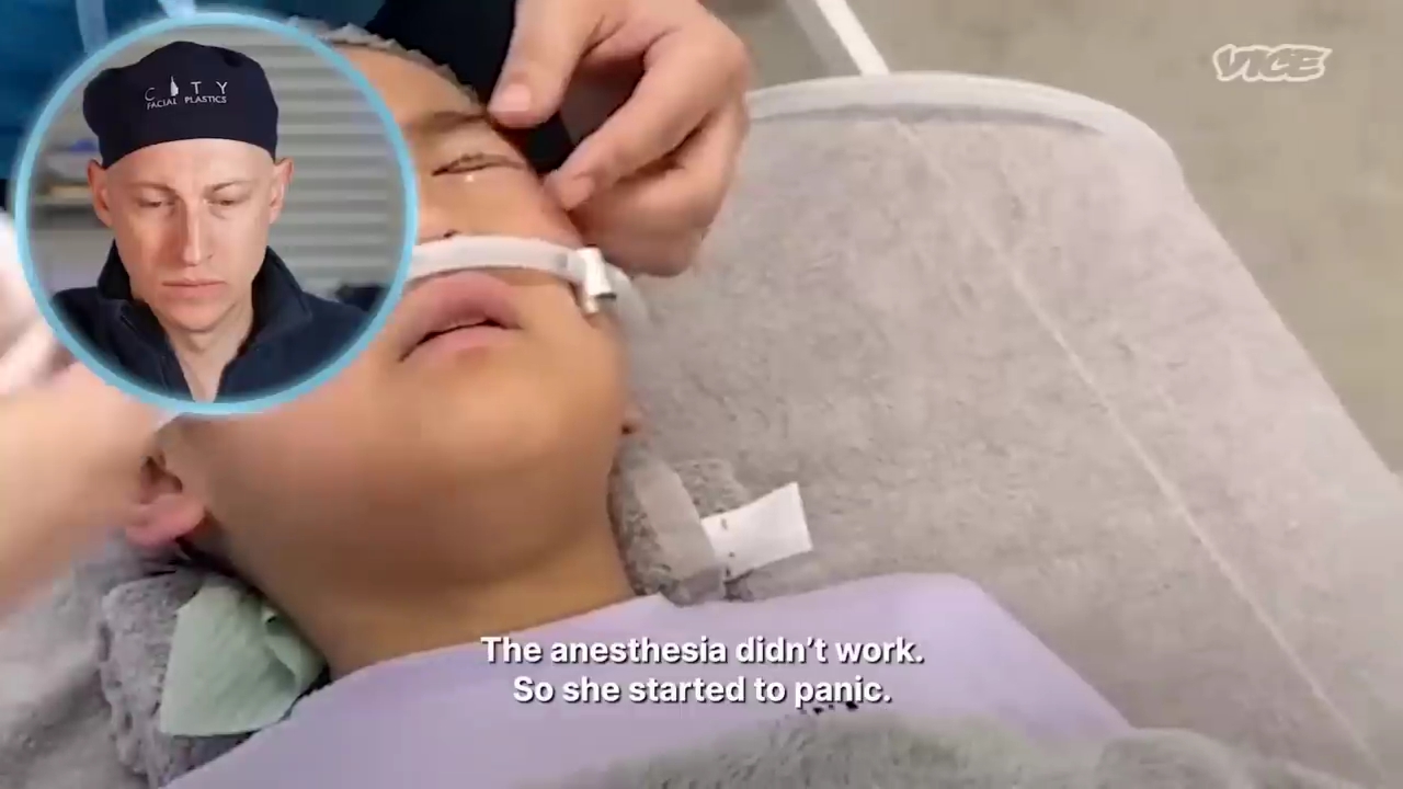 성형수술을-받는-일본-어린아이들.jpg-20-이미지