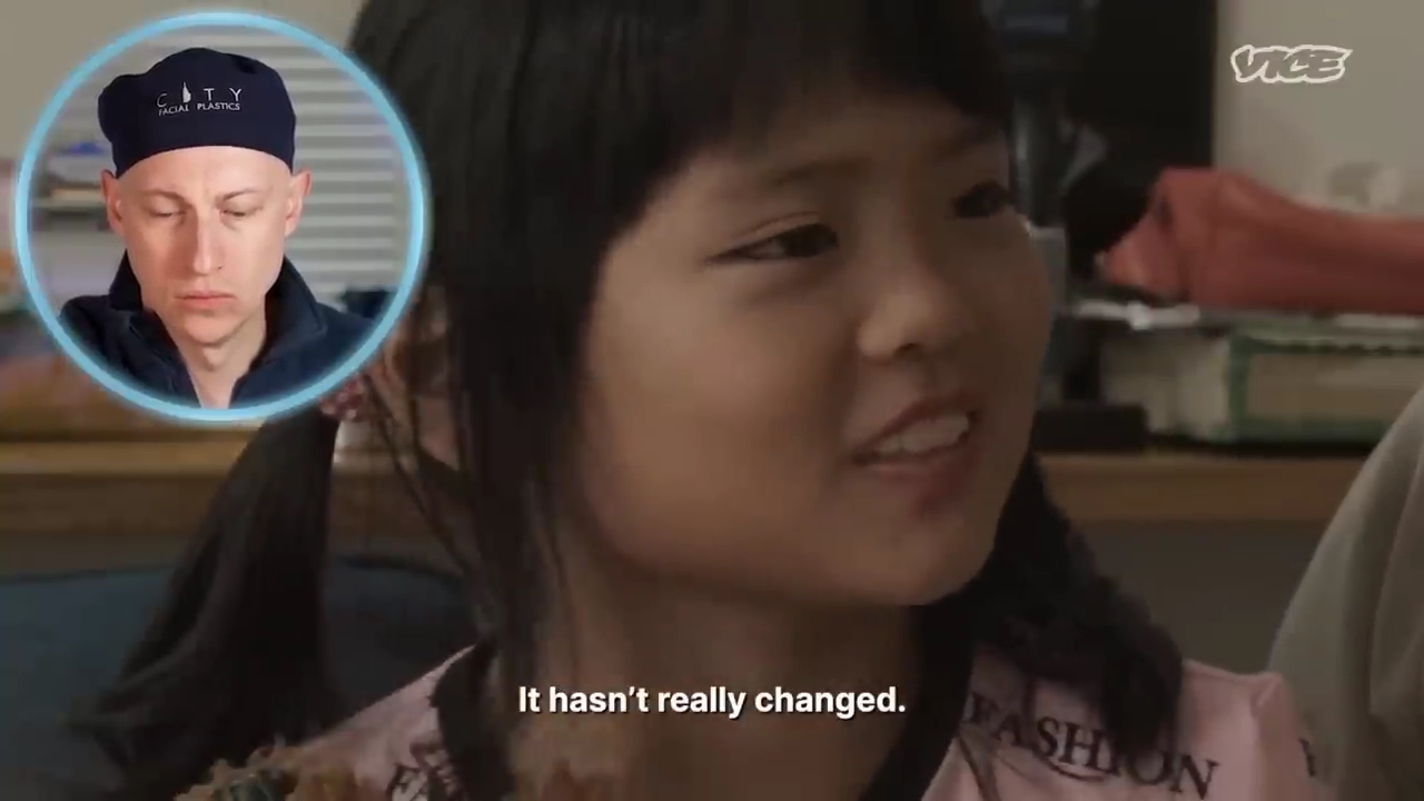 성형수술을-받는-일본-어린아이들.jpg-5-이미지