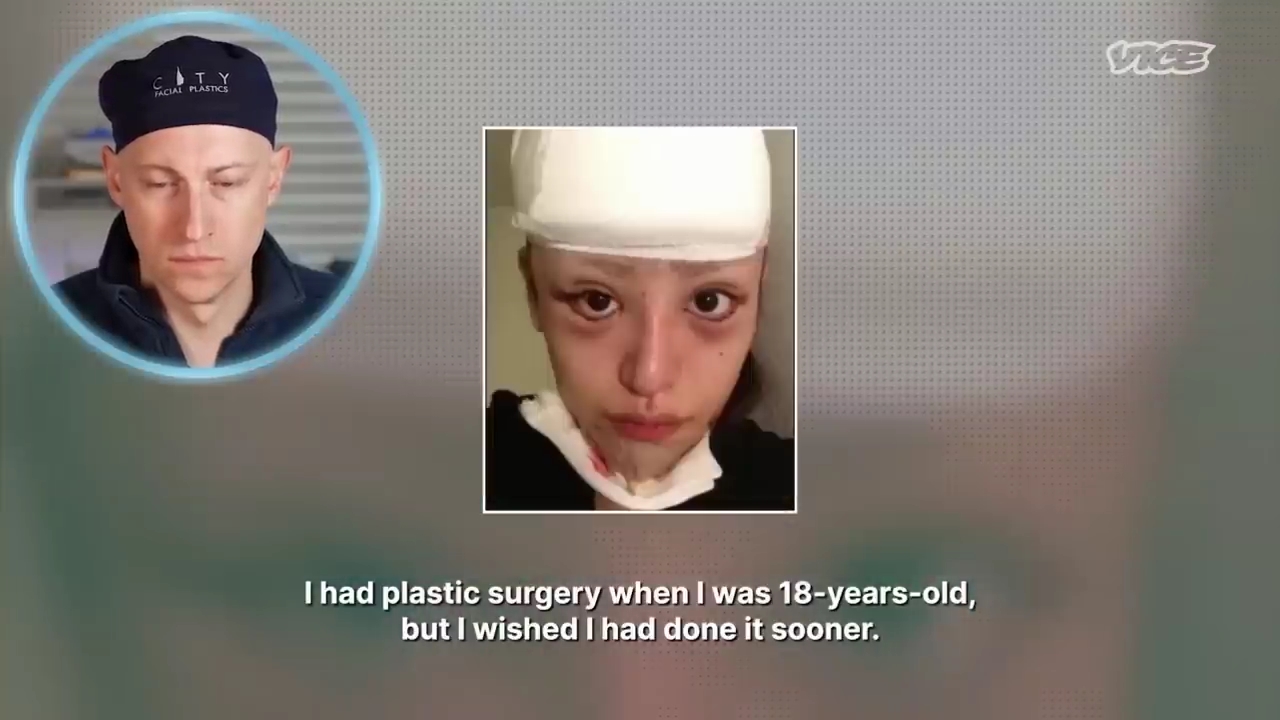 성형수술을-받는-일본-어린아이들.jpg-28-이미지