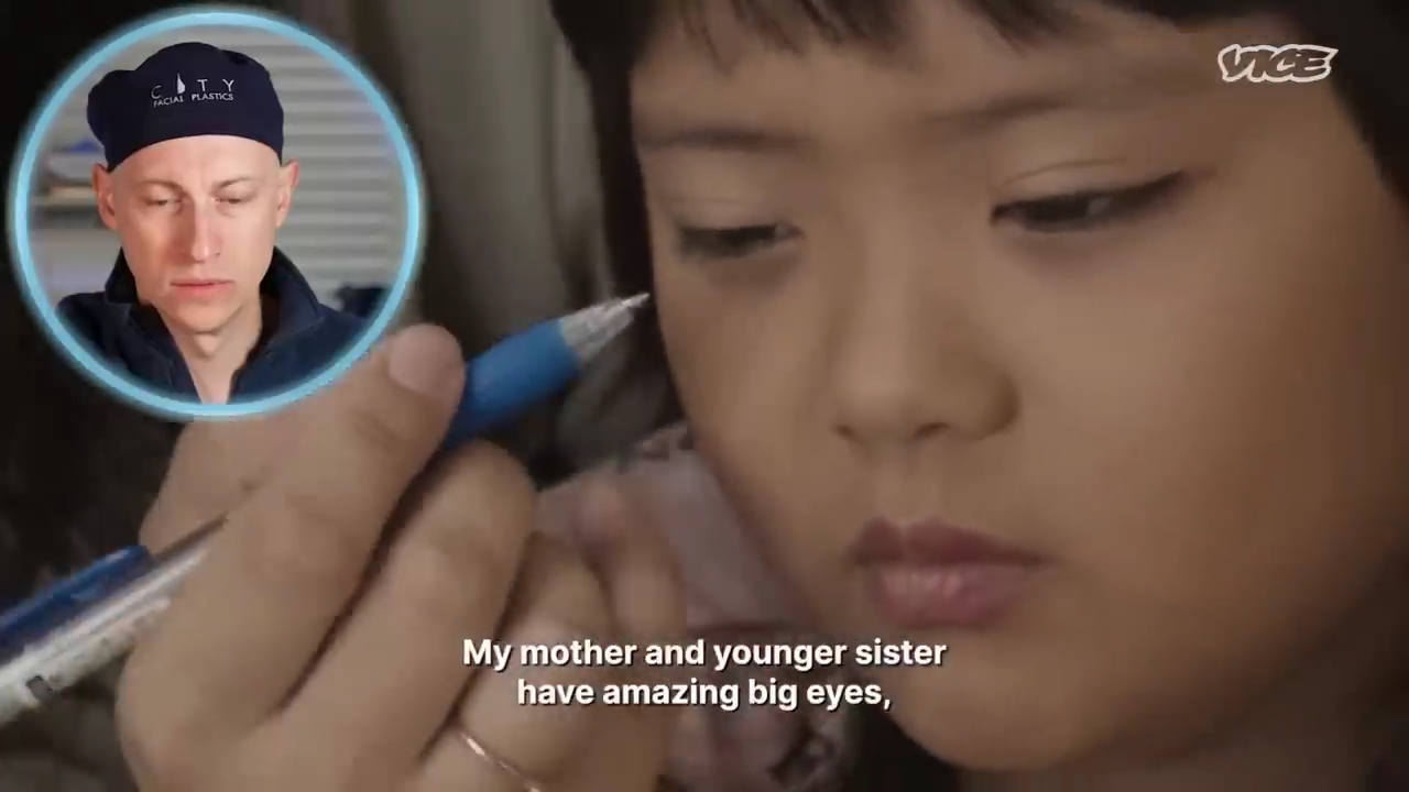 성형수술을-받는-일본-어린아이들.jpg-12-이미지