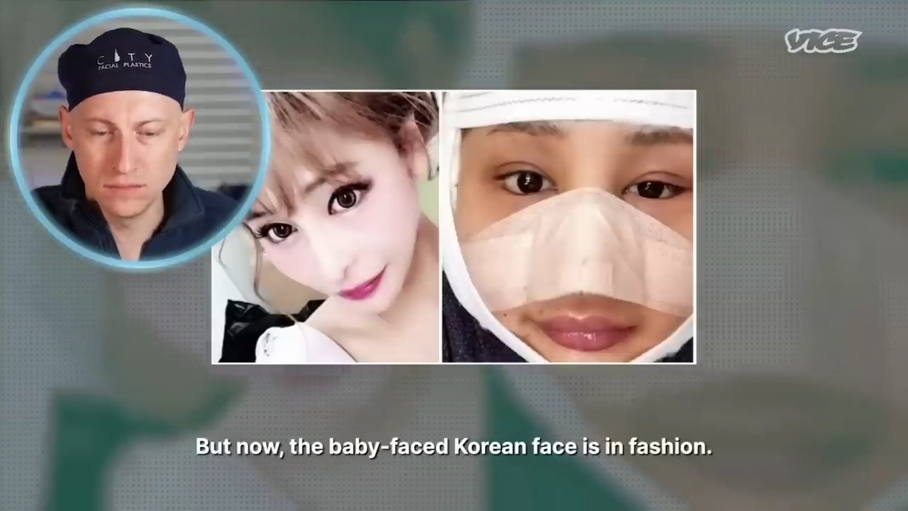 성형수술을-받는-일본-어린아이들.jpg-69-이미지