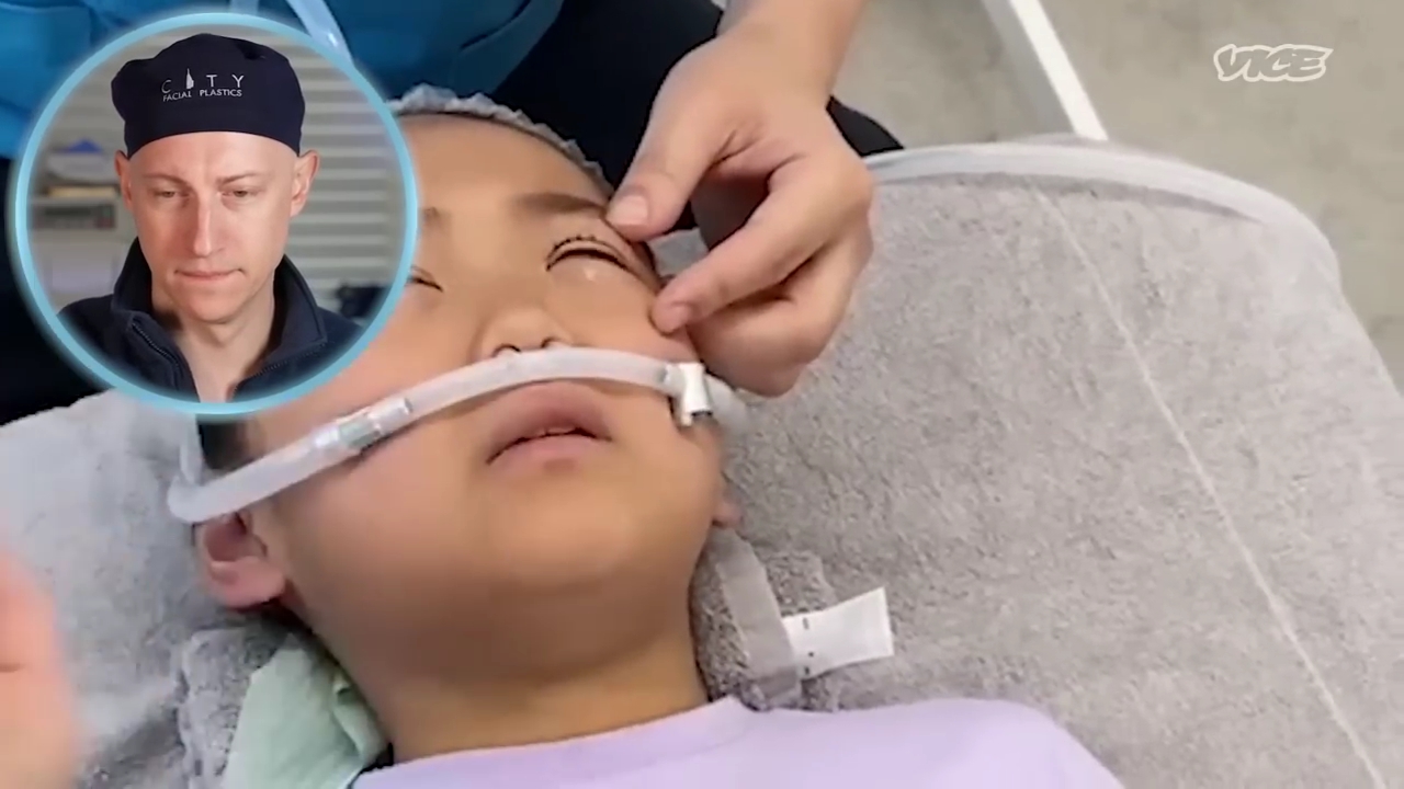 성형수술을-받는-일본-어린아이들.jpg-0-이미지