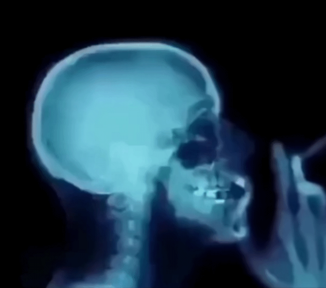 흡연시-니코틴이-뇌로-퍼지는-모습-1-이미지