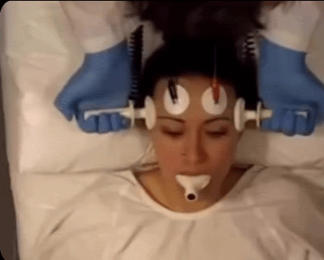 우울증-약물이-안-되면-최후의-수단-전기치료-1-이미지