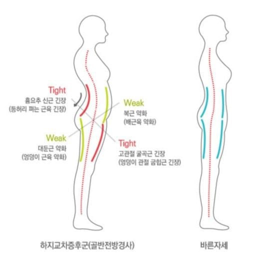 코어-근육이-무너진-사람-특징.jpg-0-이미지