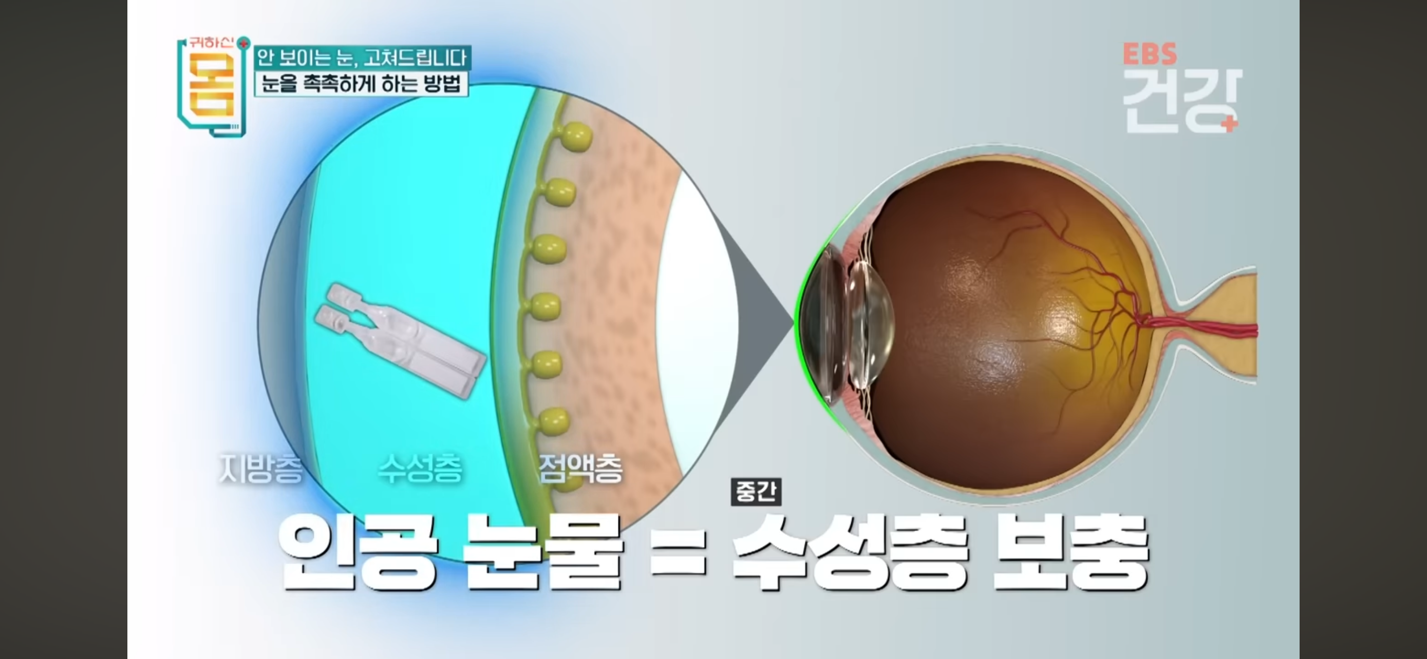 안구건강관리법-메모-1-이미지