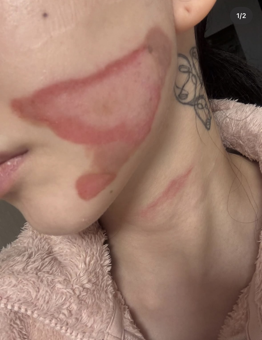 슈링크로-화상입었다는-권민아-인스타글.jpg-0-이미지